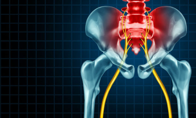 Hội chứng đau thần kinh tọa, đau cơ hình lê và yoga